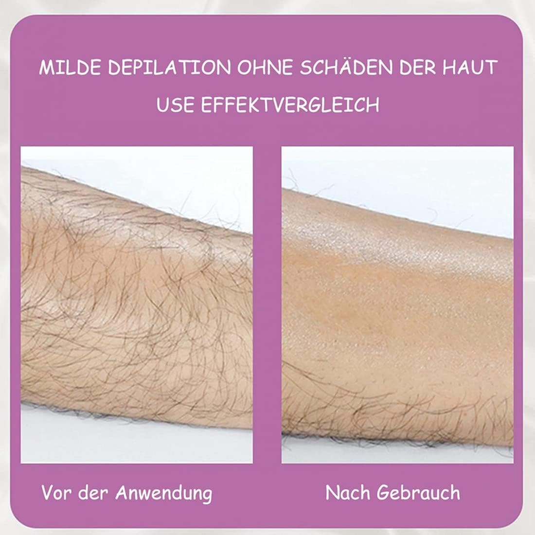 Painless Hair Removal Ladies Epilator | Free Delivery