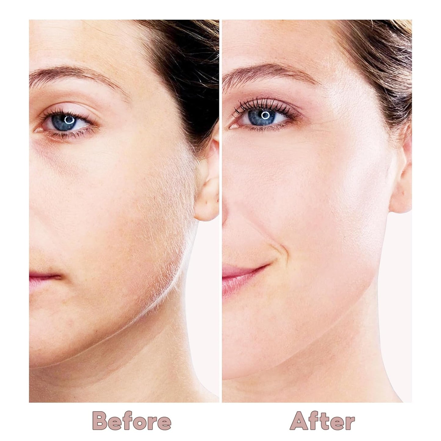 Facial Hair Remover