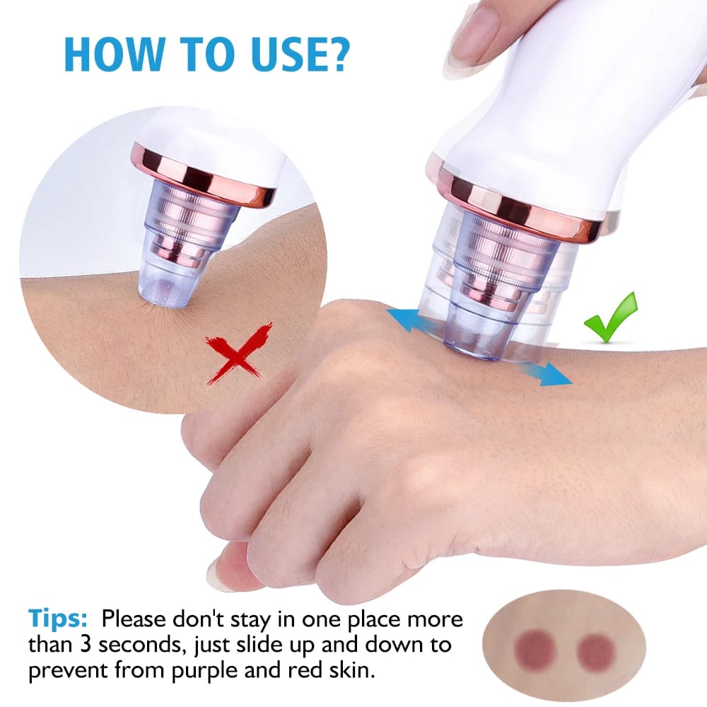 5 in 1 Blackhead remover | Rechargeable | Free Rs.500 Gift Card 🎁