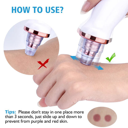5 in 1 Blackhead remover | Rechargeable | Free Rs.500 Gift Card 🎁